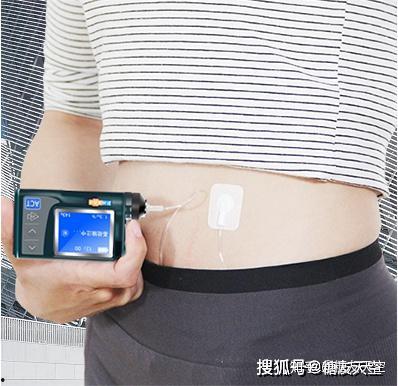 国产胰岛素泵使用视频,操作指南与体验分享